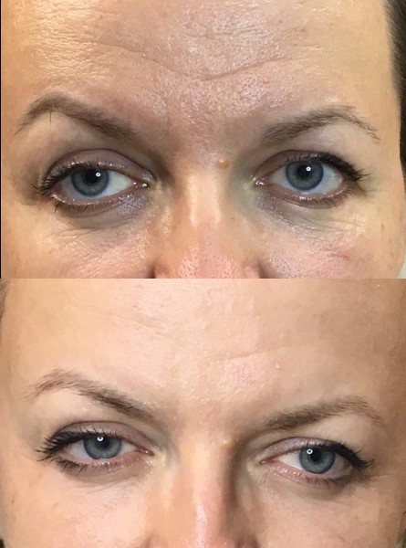 Efekt wygładzenia, regeneracji i  rozświetlenia skóry twarzy